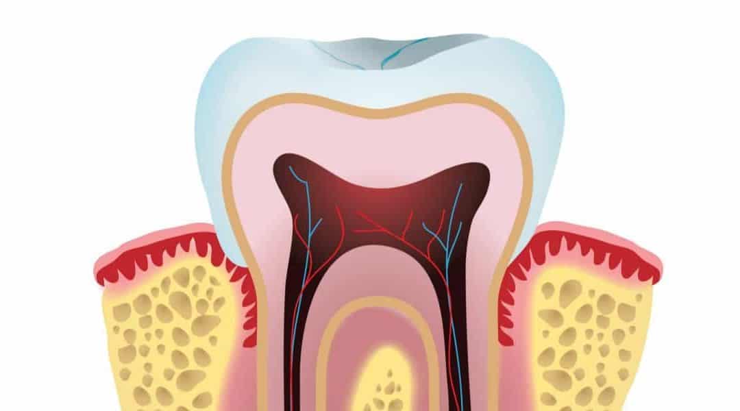 5 Helpful Facts About Dental Crown You Need To Know