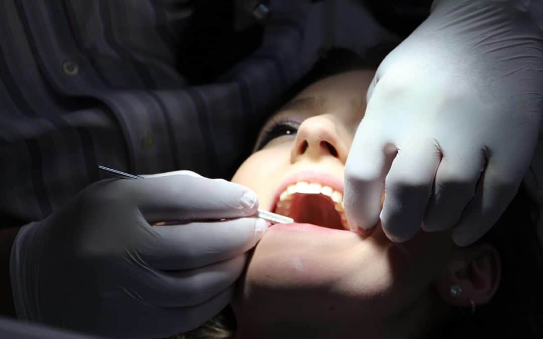 How To Know If You Need Dental Fillings