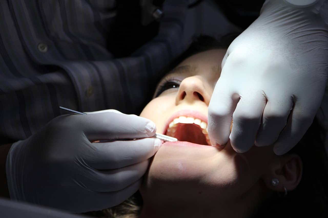 dental fillings toronto by downtown dentistry