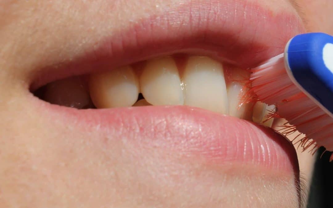 Stop Worrying About Misalignment Of Your Teeth And Get Crowded Teeth In Toronto