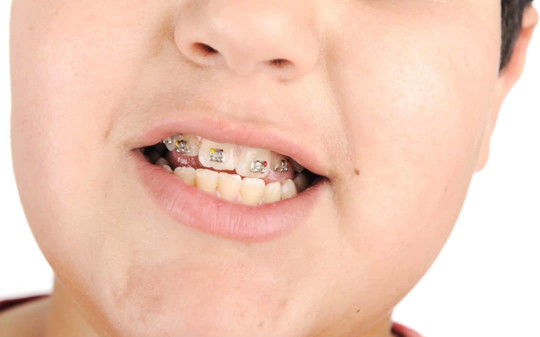 Tips In Picking The Best Orthodontics In Toronto