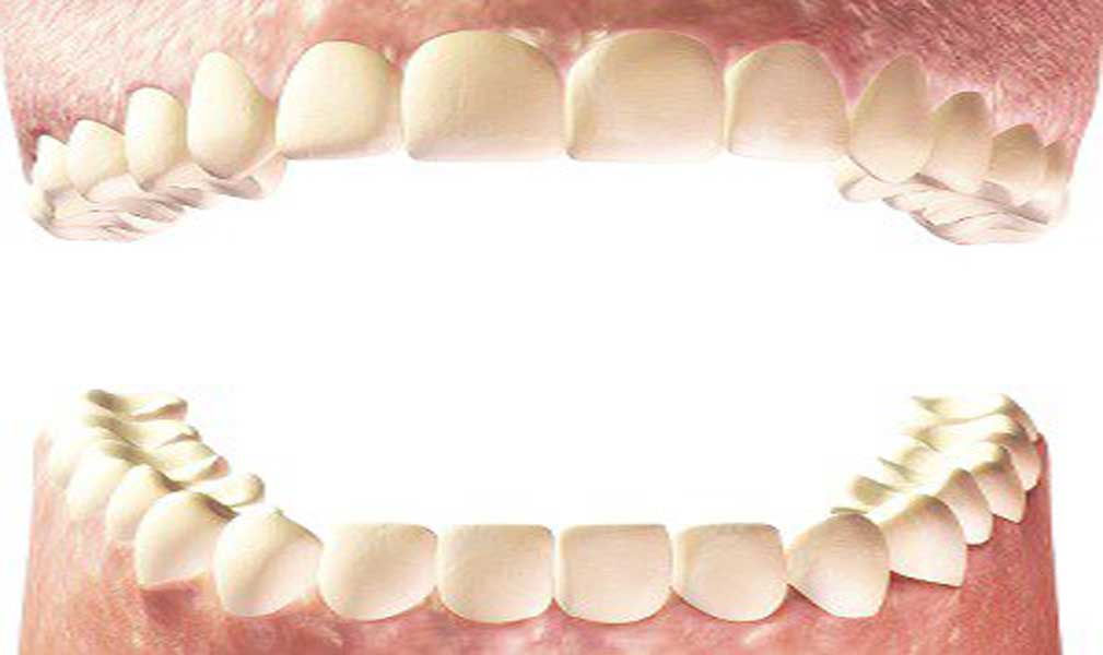 teeth model by downtown dentistry