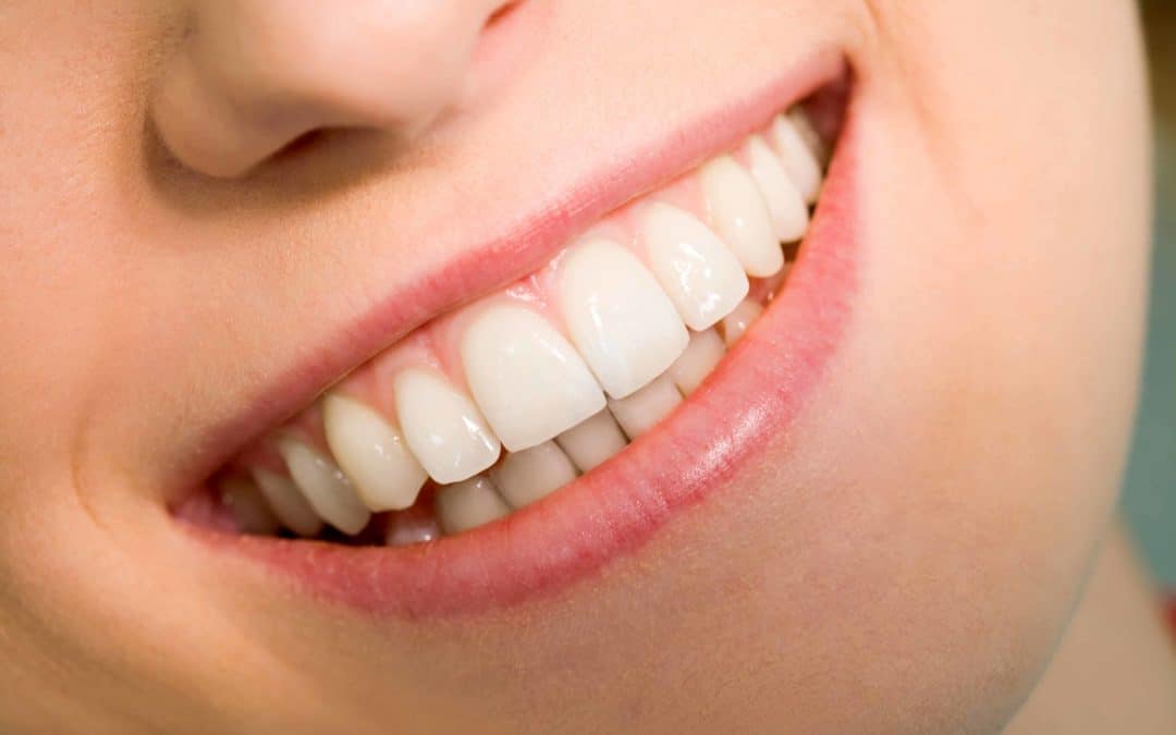 Bring Back That Perfect Smile With A Tooth Whitening Treatment