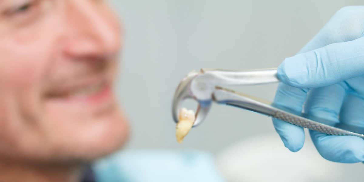 tooth extraction by downtown dentistry