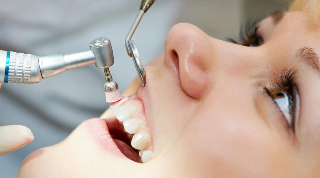 Dental Cleaning: Starting The New Year Right