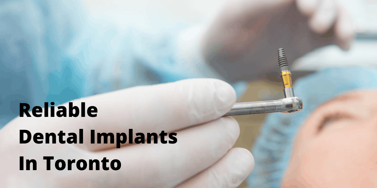 Dentist holding dental implants