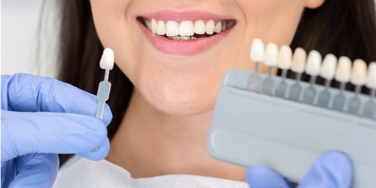 Dentist holding tooth shade for veneers