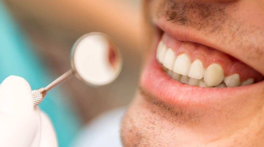 What To Expect During Your Dental Checkup In Toronto