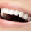Flawed To Flawless: 8 Gains Of Cosmetic Dentistry | Toronto