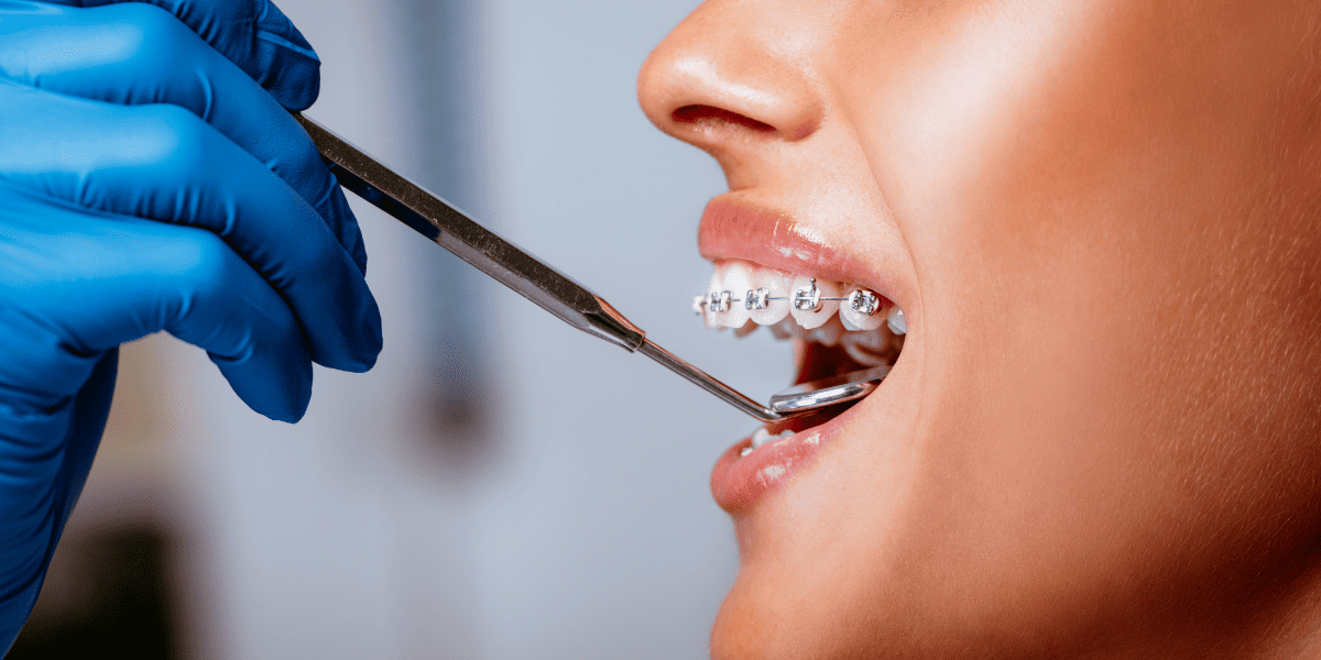 Dentist observing teeth with braces